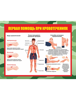 Баннер плакат Первая помощь при кровотечениях, размером 90х70 см