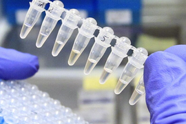 Анализы (часть 2)