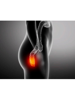 Лечение геморроя