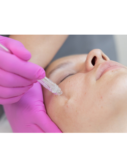 Газожидкостный пилинг (Аквапилинг)