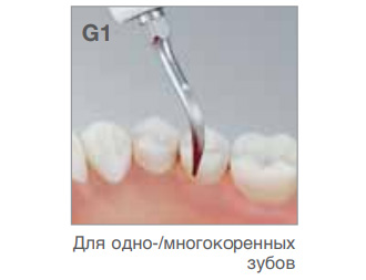 Насадка G1  к ультразвуковому скалеру Varios NSK/Satelec