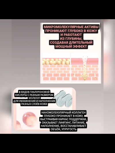 RE-MERGE Эксклюзивная маска - корсет от птоза, брылей, второго подбородка 4шт.