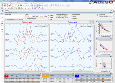 Нейро-Аудио/СВП 2-канальный прибор для проведения объективной аудиометрии (КСВП)