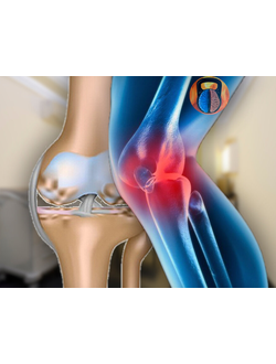Лечение опорно-двигательного аппарата