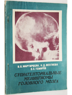 Мартиросян В.В., Мехтиева Н.Д. Супратенториальные менингиомы головного мозга. Ростов-на-Дону: Изд-во Ростовского университета. 1982.