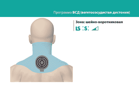 Программа &laquo;ВСД&raquo;. ДЭНАС-ПКМ | НЕЙРОДЭНС-ПКМ. 