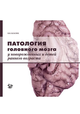 Патология головного мозга у новорожденных и детей раннего возраста. Власюк В.В. &quot;Логосфера&quot;. 2014