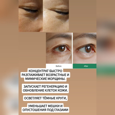 KREAM MILK Концентрат от мешков под глазами, для лифтинга и подтяжки нависшего века, разглаживания морщин 10гр.