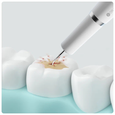Ультразвуковой скалер Xiaomi Dr. Bei YC2 Ultrasonic Tooth Cleaner