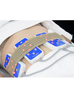 Лазерный липолиз