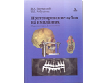 Протезирование зубов на имплантатах. 2-е издание, доп. Загорский В.А., Робустова Т.Г. &quot;БИНОМ&quot;. 2016