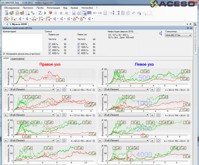 Нейро-Аудио/СВП 2-канальный прибор для проведения объективной аудиометрии (КСВП)
