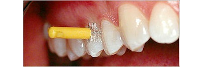 Межзубные ершики Dental Brush M, 0,6 мм, синие,  Plackers, 24 шт.