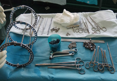 аппарат илизарова, стержень, полукольцо, удлинение конечностей, ЦИТО, РНЦ ВТО, илизаров, аппарат