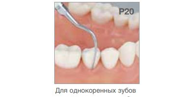 Насадка P20 пародонтологическая к ультразвуковым скалерам Varios