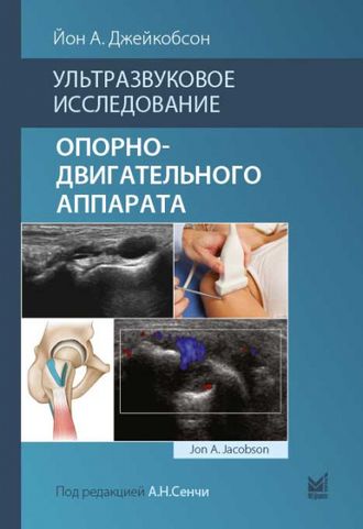 Ультразвуковое исследование опорно-двигательного аппарата. Джейкобсон, Йон А. &quot;МЕДпресс-информ&quot;. 2023