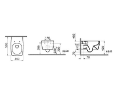 Комплект: подвесной безободковый унитаз VitrA Metropole Rim-Ex, с тонким сиденьем с микролифтом, инсталяцией и панелью управления, 9820B003-7201