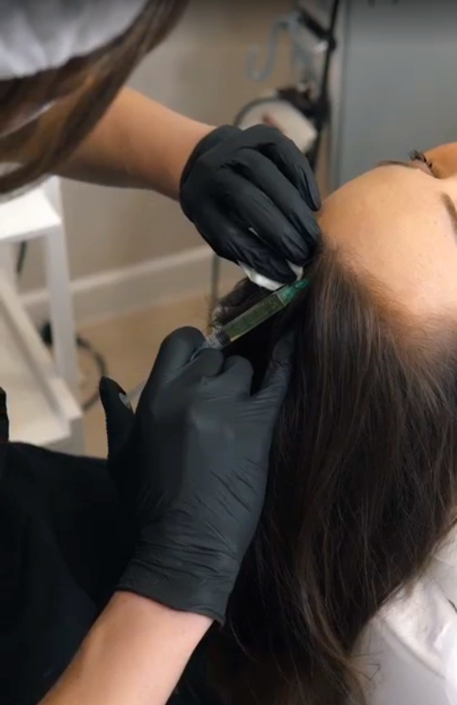 Мезотерапия волосистой части головы в Цикада Клиник Тверь
