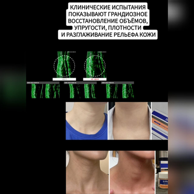 Dr.Melaxin Лифтинг уход для шеи: концентрат 1,5мл*10шт. и крем 50мл