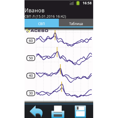 Аудио-СМАРТ cистема для ОАЭ, КСВП, импедансометрии и аудиологического скрининга