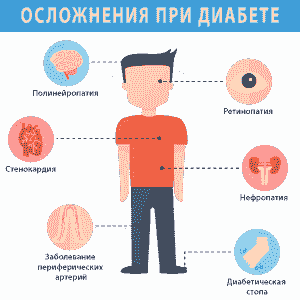 осложнения при диабете. ДЭНАС ПКМ | НЕЙРОДЭНС. 