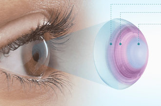 DAILIES TOTAL 1 multifocal (30 ЛИНЗ)