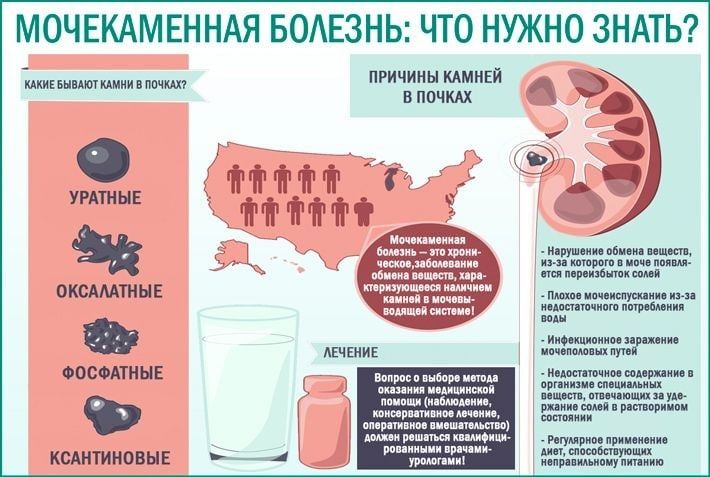 Причины мочекаменного заболевания. Профилактика камней в почках. Мочекаменная и Почечнокаменная болезнь. Профилактика камней випочках. Мочекаменная болезнь симптомы и профилактика.