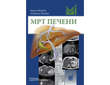 МРТ печени. Диагностика, дифференциальная диагностика, принципы лечения. Фишбах Ф. &quot;МЕДпресс-информ&quot;. 2018