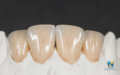 YUCERA Zirconia ST White - Высококачественное стоматологическое решение