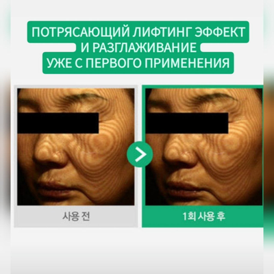 TERAPIC Система ухода с PDRN для омоложения и усиленной регенерации кожи (3 средства)