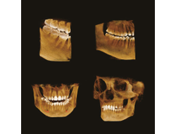 Papaya 3D 16x14 - компьютерный томограф без цефалостата Genoray Co., Ltd (Республика Корея)