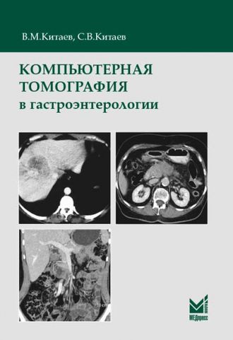 Компьютерная томография в гастроэнтерологии: руководство для врачей. Китаев В.М. &quot;МЕДпресс-информ&quot;. 2019