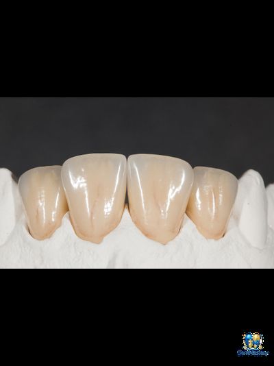 YUCERA Zirconia ST White - Высококачественное стоматологическое решение