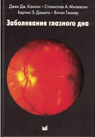 Заболевания глазного дна. Кански Дж.Дж., Милевски С.А., Дамато Б.Э., Тэннер В. &quot;МЕДпресс-информ&quot;. 2024