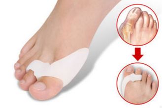 Фиксатор+корректор большого пальца ноги (лечение вальгусной деформации стопы медицинским силиконом)