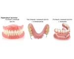 Протезирование зубов (ортопедия)