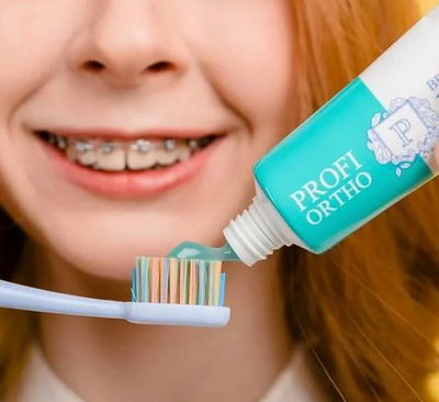 Зубная паста Profi Ortho Braces (для брекет-систем), PresiDENT, 50 мл. (копия)