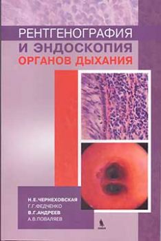 Рентгенография и эндоскопия органов дыхания. Чернеховская Н.Е., Федченко Г.Г., Андреев В.Г., Поваляев А.В. &quot;БИНОМ&quot;. 2020