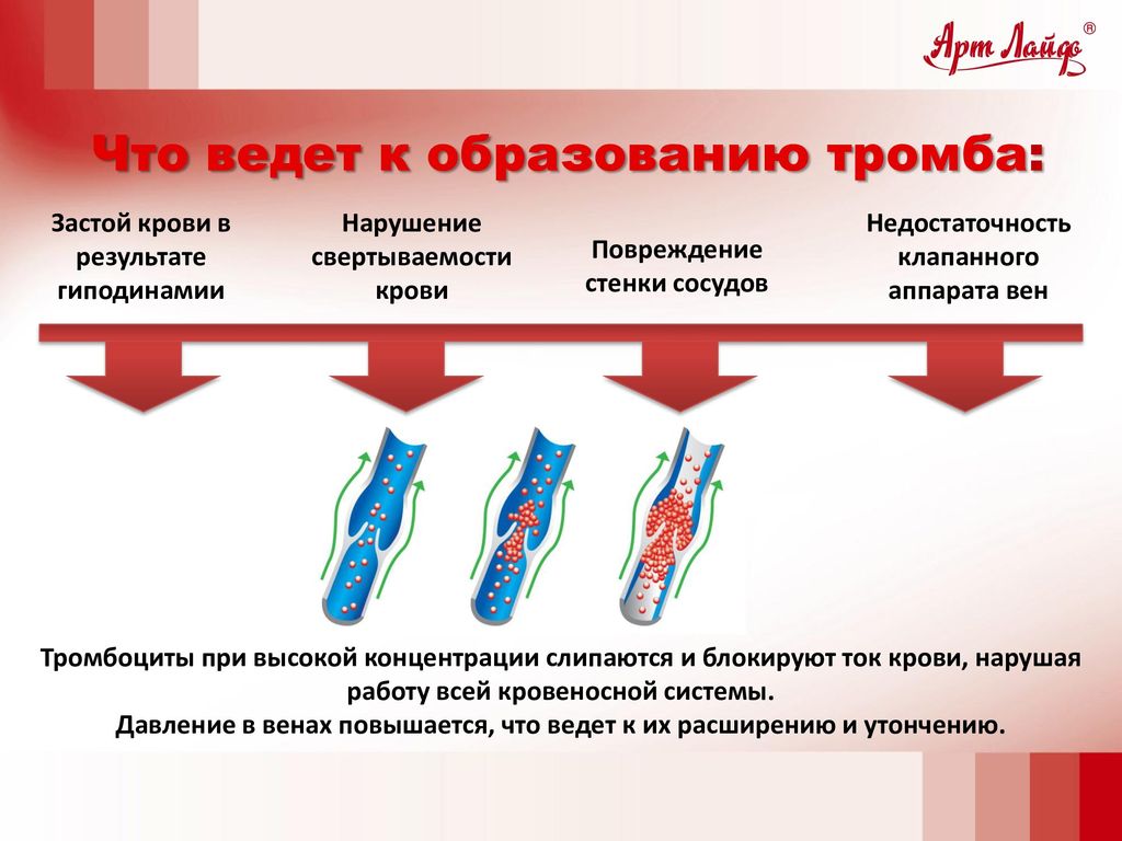 Что Можно Купить В Турции От Тромбообразования
