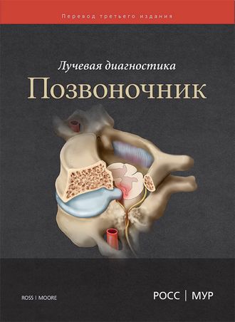 Лучевая диагностика. Позвоночник. Дж. С. Росс, К. Р. Мур и др. &quot;Издательство Панфилова&quot;. 2018