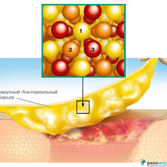 Грануфлекс с окантовкой (Granuflex Bordered) 15х18 см (для крестца)