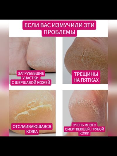 PETITFEE Маски с сухой эссенцией для смягчения кожи ног 5 пар