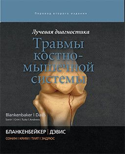 Лучевая диагностика. Травмы костно-мышечной системы. Д. Г. Бланкенбейкер, К. У. Дэвис и др. &quot;Издательство Панфилова&quot;. 2019