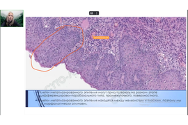 Курс по цитопатологии шейки матки