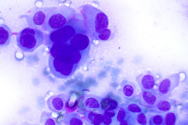 Цитологическая диагностика патологии кожи (онлайн курс)