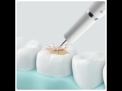 Ультразвуковой скалер Xiaomi Dr. Bei YC2 Ultrasonic Tooth Cleaner