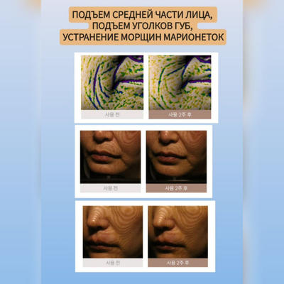 MARSHIQUE Маски для разглаживания и лифтинга зоны улыбки 3 пары