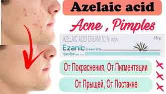 Крем от Прыщей и Постакне Ezanic 10% с азелаиновой кислотой Azelaic Acid 15 g