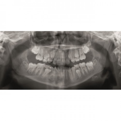 Gendex GXDP-300™ - Цифровая панорамная рентгенодиагностическая система | KAVO DENTAL (Германия)