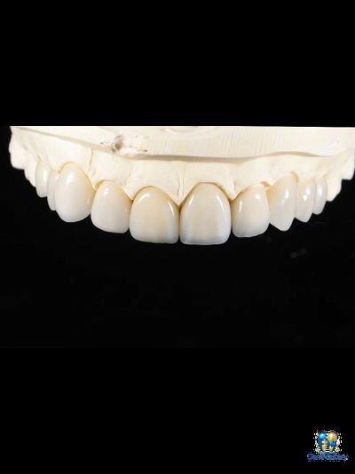 Yucera HT White Zirconia – Прозрачный и Прочный Цирконий для Стоматологии
